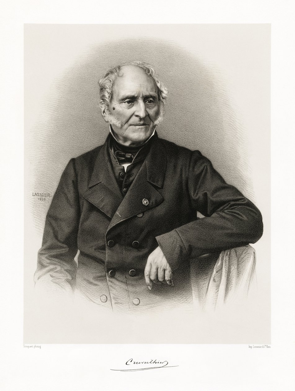 Jean Cruveilhier, 1865-66 tekijältä Lasnier