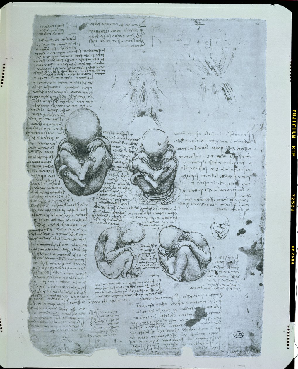 Viisi näkymää kohdussa olevasta sikiöstä, faksikopio tekijältä Leonardo da Vinci