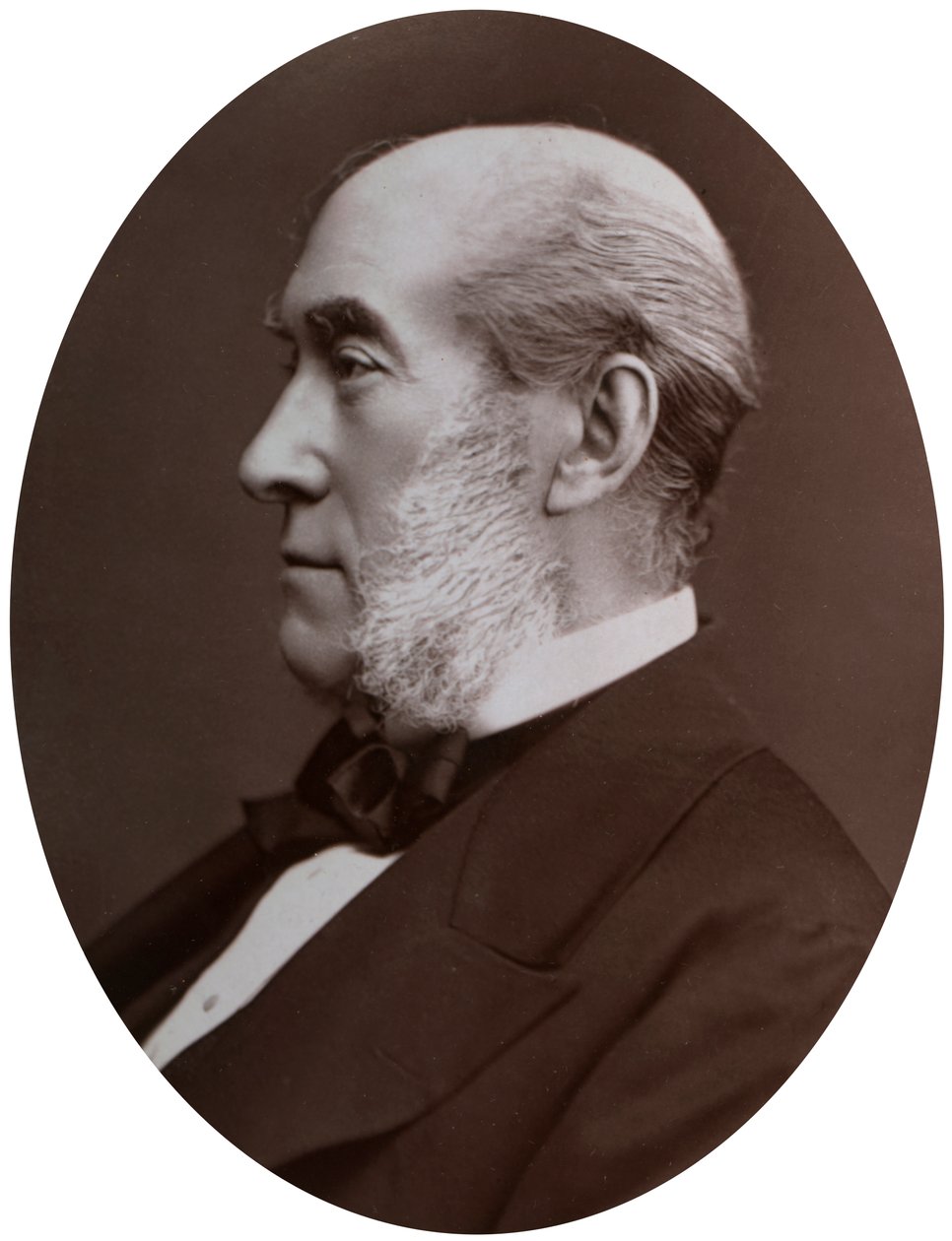 Sir William Fergusson, Bart, FRS, kuningattaren kersantti-kirurgi, 1877. tekijältä Lock and Whitfield
