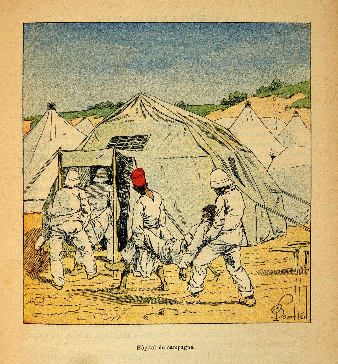 Madagaskarin sota - Henri Galli dit Galllichetin (1854-1922) ranskalaisten tutkimusretkien anekdoottinen historia, kuvittanut Louis Bombled (1862-1927): Sotilaskenttäsairaala Madagaskarilla vuonna 1895, yksityinen kokoelma tekijältä Louis Charles Bombled