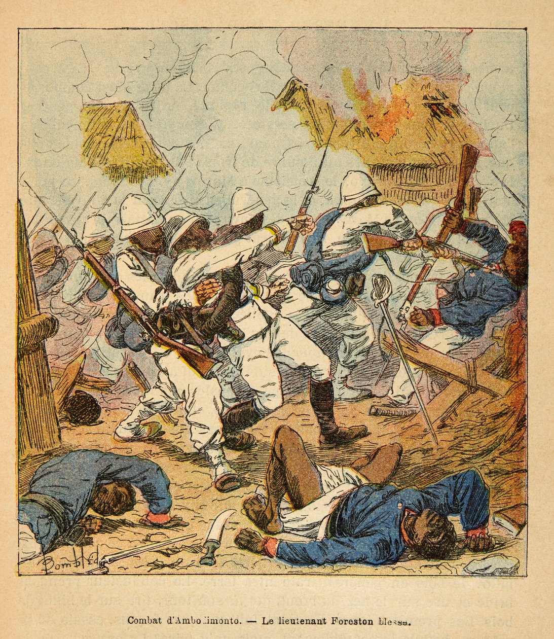 Madagaskarin sota - Henri Galli dit Galllichet (1854-1922) ranskalaisten tutkimusretkien anekdoottinen historia, kuvittanut Louis Bombled (1862-1927): Luutnantti Forestonin haavat Ambolomontyn taisteluissa vuonna 1895, yksityinen kokoelma tekijältä Louis Charles Bombled