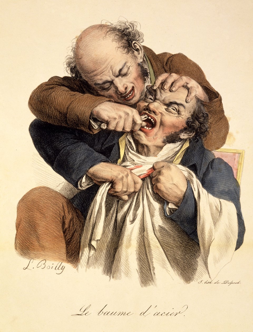 Teräsbalsami – Hammasveto, pub. Pariisissa, 1826 tekijältä Louis Leopold Boilly