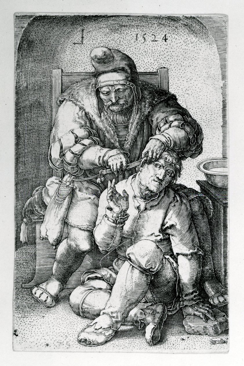 Kirurgi, 1524 tekijältä Lucas van Leyden