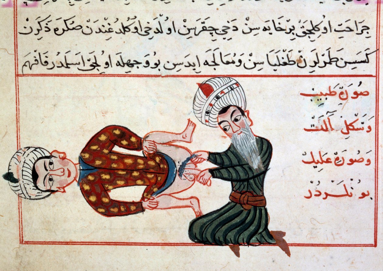 Lääketiede: hermafodiitin laihtuminen. Miniatyyri Sharaf al-dinin turkkilaisen lääketieteen kohteesta tekijältä Ottoman School