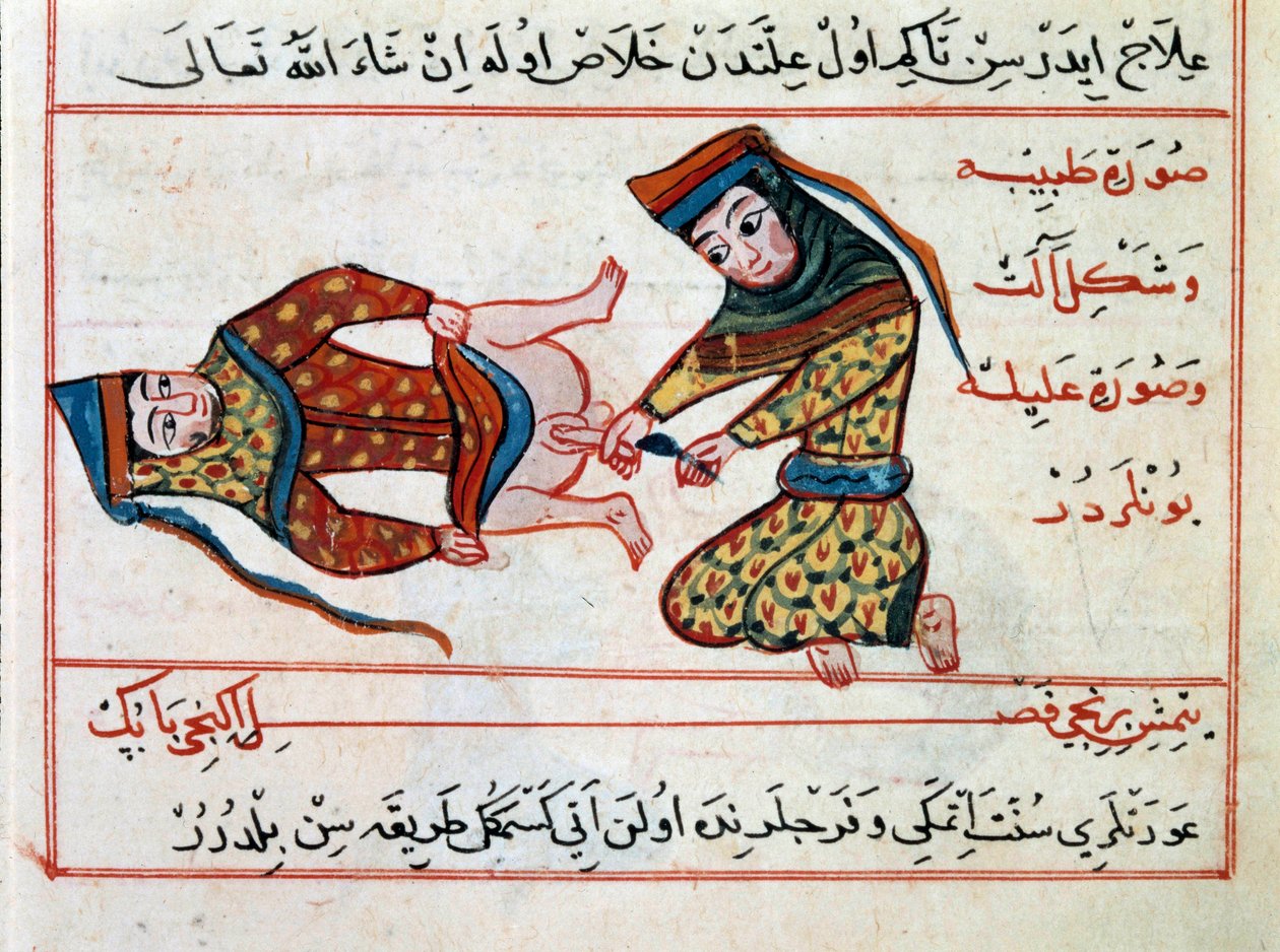 Lääketiede: hermafodiitin leikkaus. Miniatyyri Sharaf al-dinin turkkilaisen lääketieteen kohteesta tekijältä Ottoman School