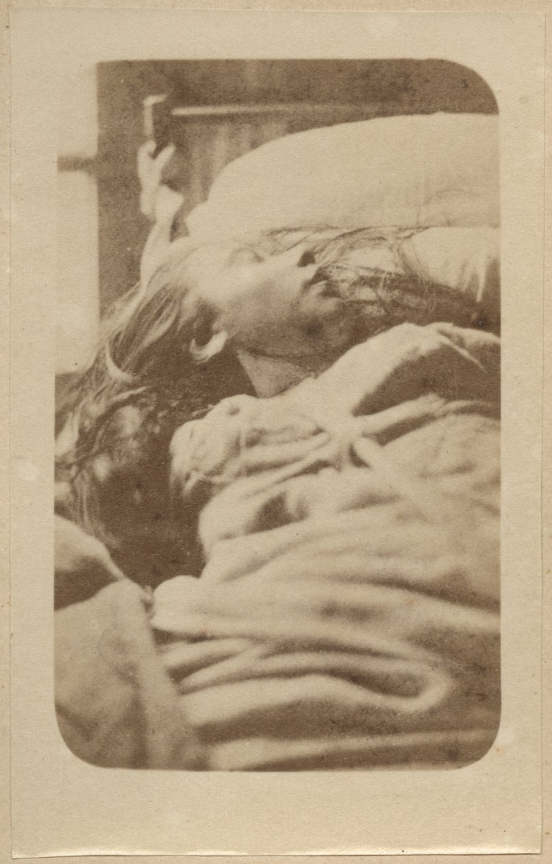 Hysteriahyökkäys, ensimmäinen vaihe, kuvitus teoksesta "Iconographie Photographique de La Salpetriere", Bourneville et P. Regnard, levy II, Pariisi, 1876 (albumiprintti) tekijältä Paul Regnard