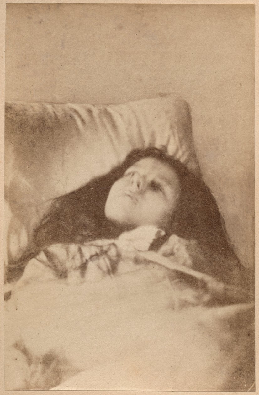 Hysteriahyökkäys, kolmas vaihe, levy IV julkaisusta "Iconographie Photographique de La Salpetriere", Bourneville ja P. Regnard, Pariisi, 1876 (albumiprintti) tekijältä Paul Regnard
