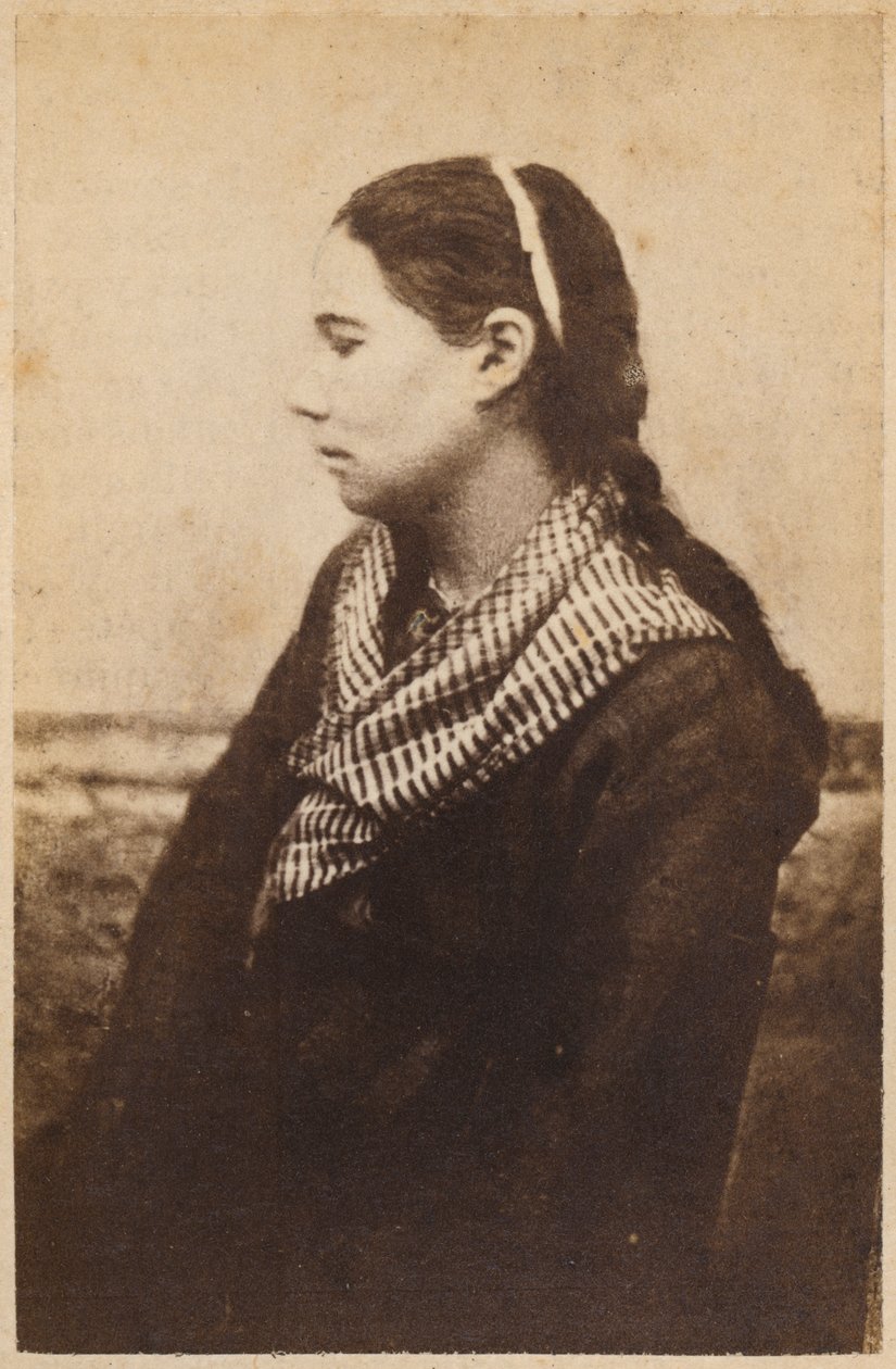 Hysteerinen epilepsia, ensimmäiset oireet hyökkäyksestä, kuvitus teoksesta "Iconographie Photographique de La Salpetriere", Bourneville et P. Regnard, levy XIV, Pariisi, 1876 (albumiprintti) tekijältä Paul Regnard