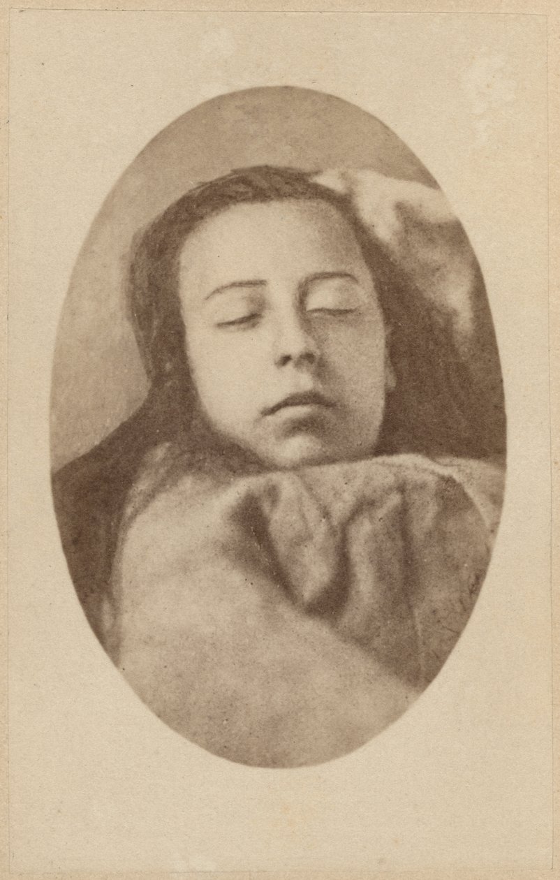 Hysteriakohtaus, toinen vaihe, kuvitus Bournevillen ja P:n julkaisemasta "Iconographie Photographique de La Salpetriere". Regnard, levy III, Pariisi, 1876 (valkopainatus). tekijältä Paul Regnard