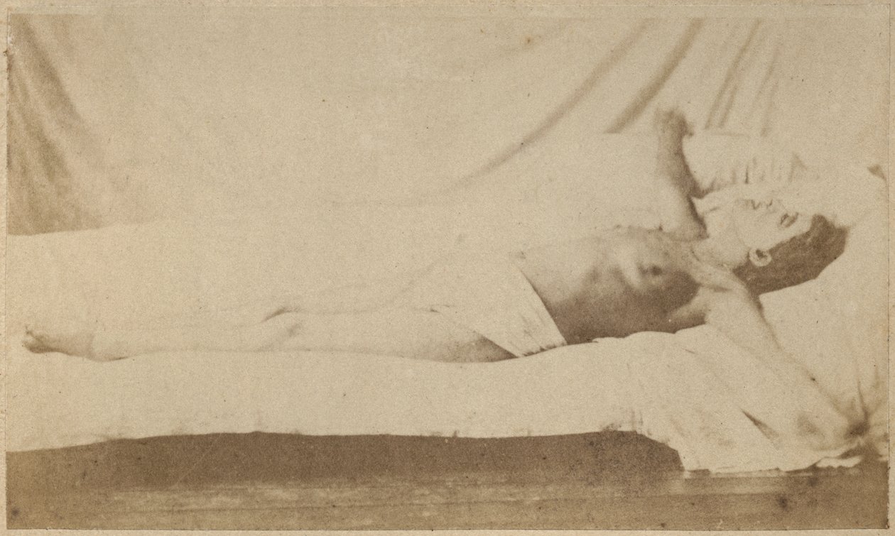 Hysteerinen epilepsia, kohtaus, ristiinnaulitseminen, levy VI julkaisusta "Iconographie Photographique de La Salpetriere", Bourneville et P. Regnard, Paris, 1876 (albumiprintti) tekijältä Paul Regnard