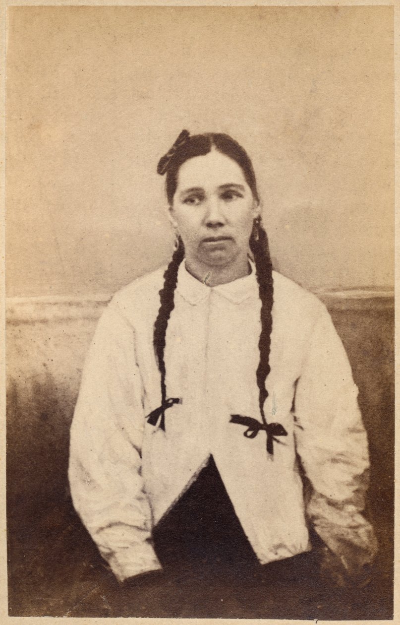 Hysteerinen epilepsia, kohtauksen alku, kuvitus julkaisusta "Iconographie Photographique de La Salpetriere", levy XV, Bourneville et P. Regnard, Pariisi, 1876 (albumiprintti) tekijältä Paul Regnard