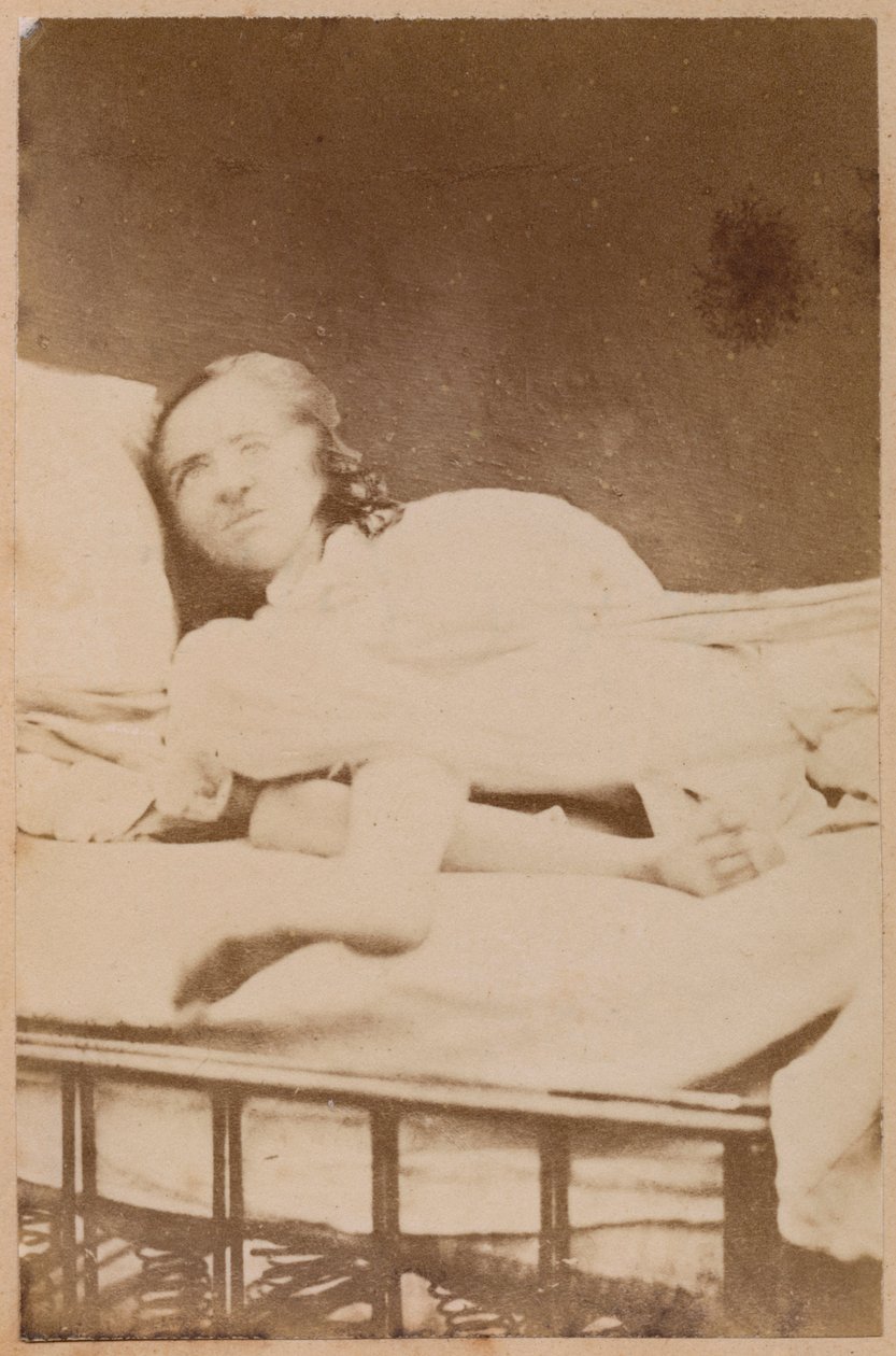 Hysteerinen epilepsia, vääntymät, levy XXXVIII Bournevillen ja P. Regnardin teoksesta "Iconographie Photographique de La Salpetriere", Pariisi, 1876 (albumiprintti) tekijältä Paul Regnard