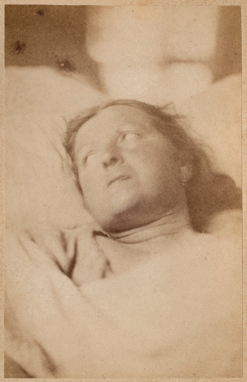 Hysteerinen epilepsia, ristiinnaulitseminen, pään asenne, levy VII teoksesta "Iconographie Photographique de La Salpetriere", Bourneville et P. Regnard, Paris, 1876 (albumiprintti) tekijältä Paul Regnard