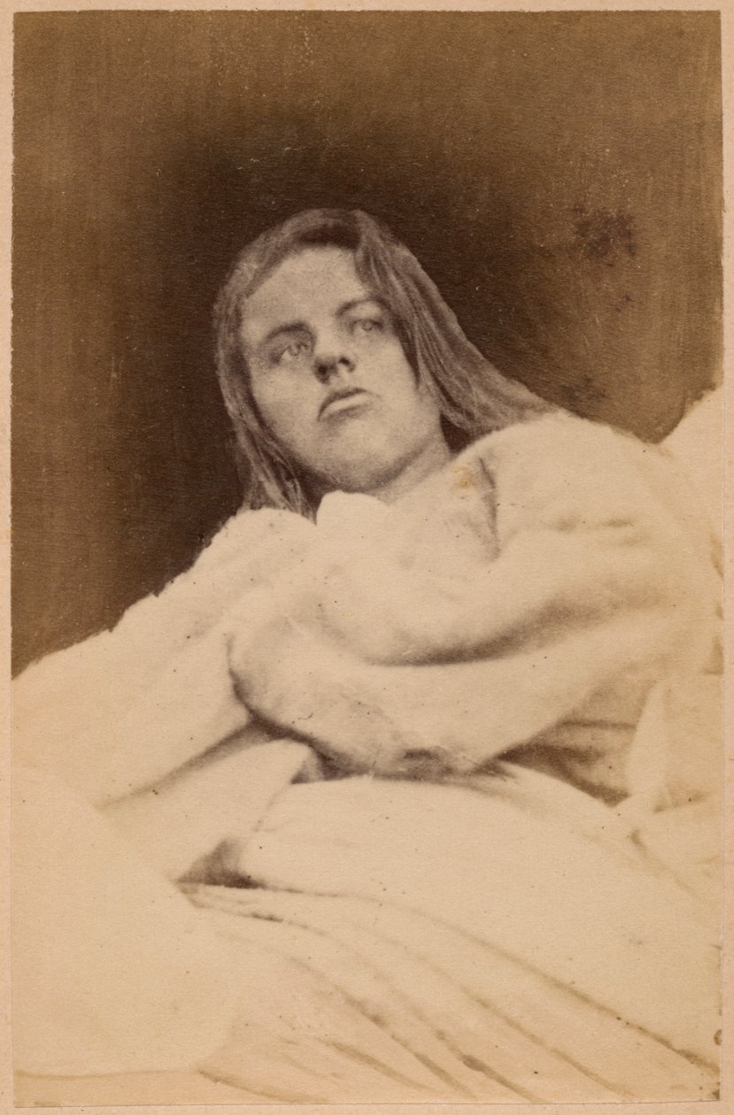 Hysteerinen epilepsia, hallusinaatiot, halveksuminen, levy XXXI julkaisusta "Iconographie Photographique de La Salpetriere", Bourneville ja P. Regnard, Pariisi, 1876 (albumiprintti) tekijältä Paul Regnard