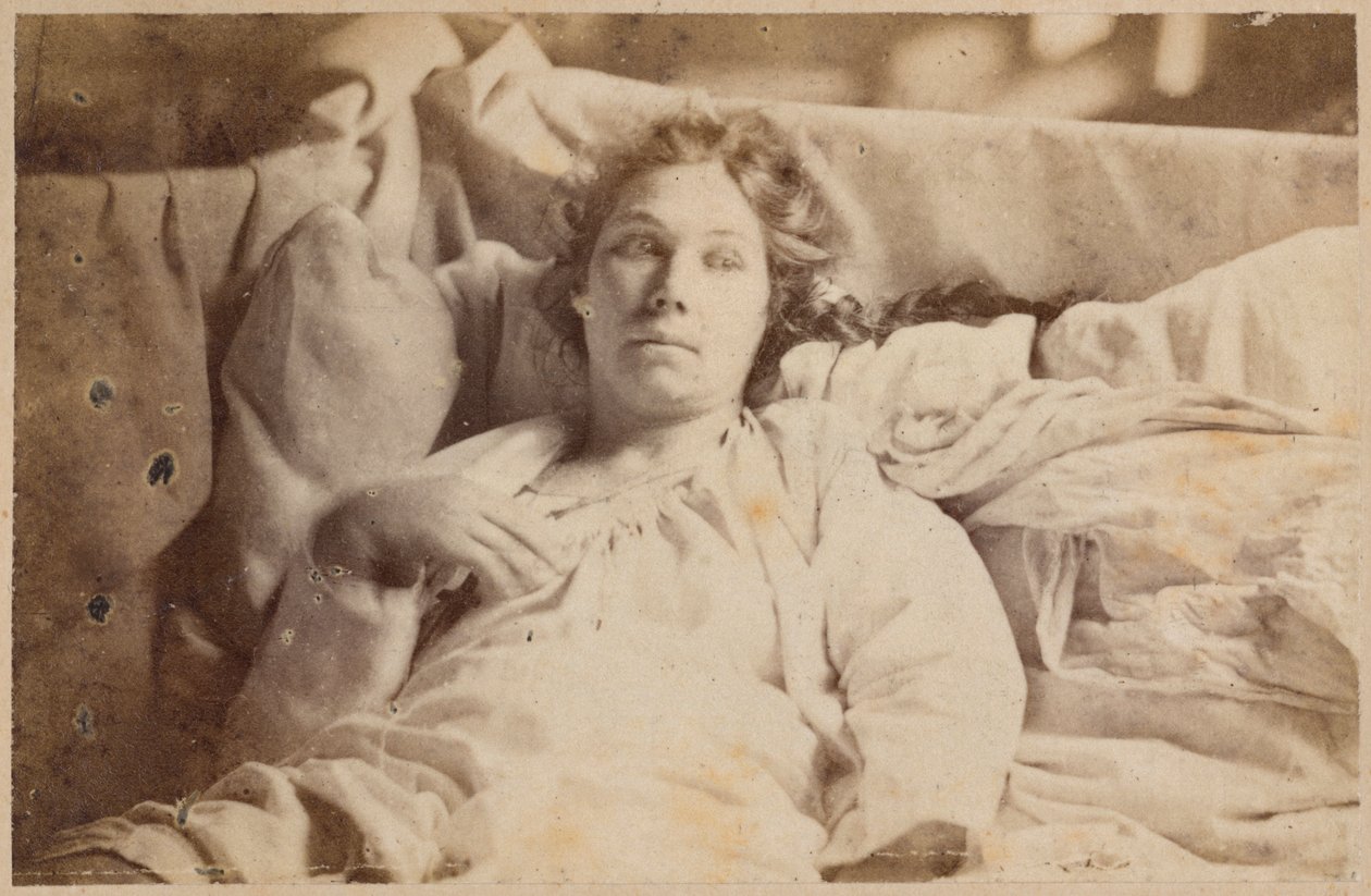 Hysteerinen epilepsia, terminaalinen vaihe, melankolinen delirium, kuvitus Bourneville et P. Regnardin teoksesta "Iconographie Photographique de La Salpetriere", levy XIX, Pariisi, 1876 (albumiprintti) tekijältä Paul Regnard