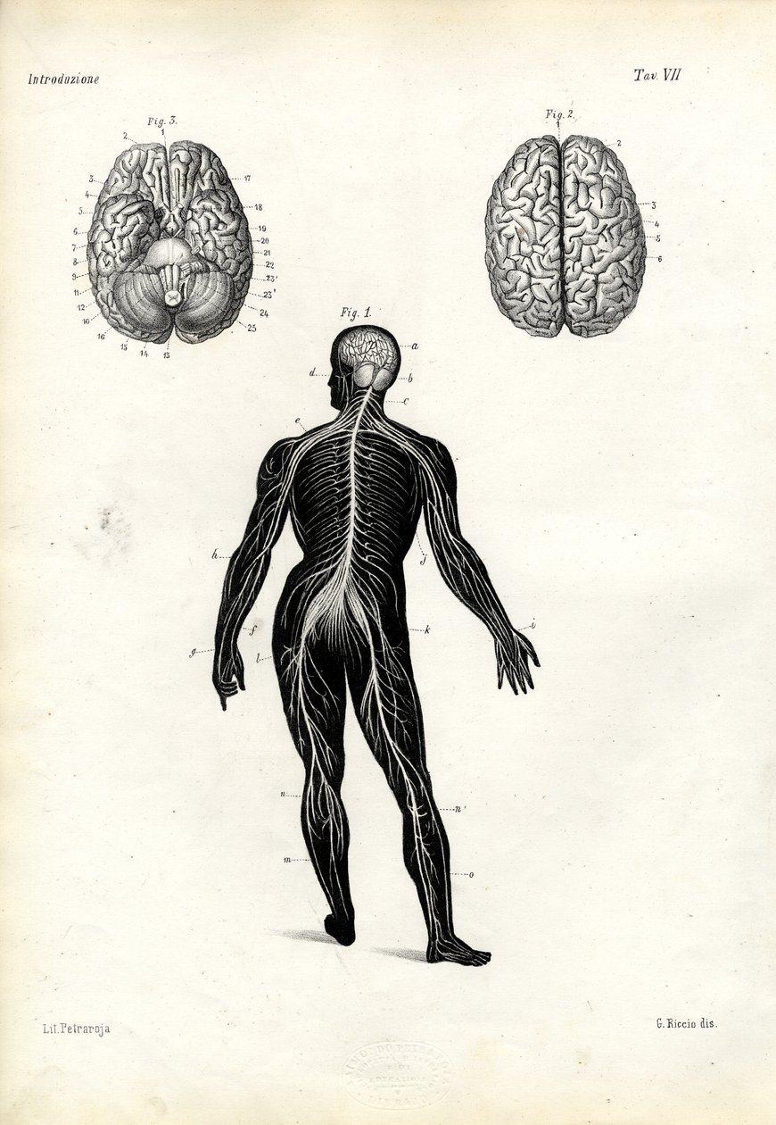 Brain, 1863-79 tekijältä Raimundo Petraroja