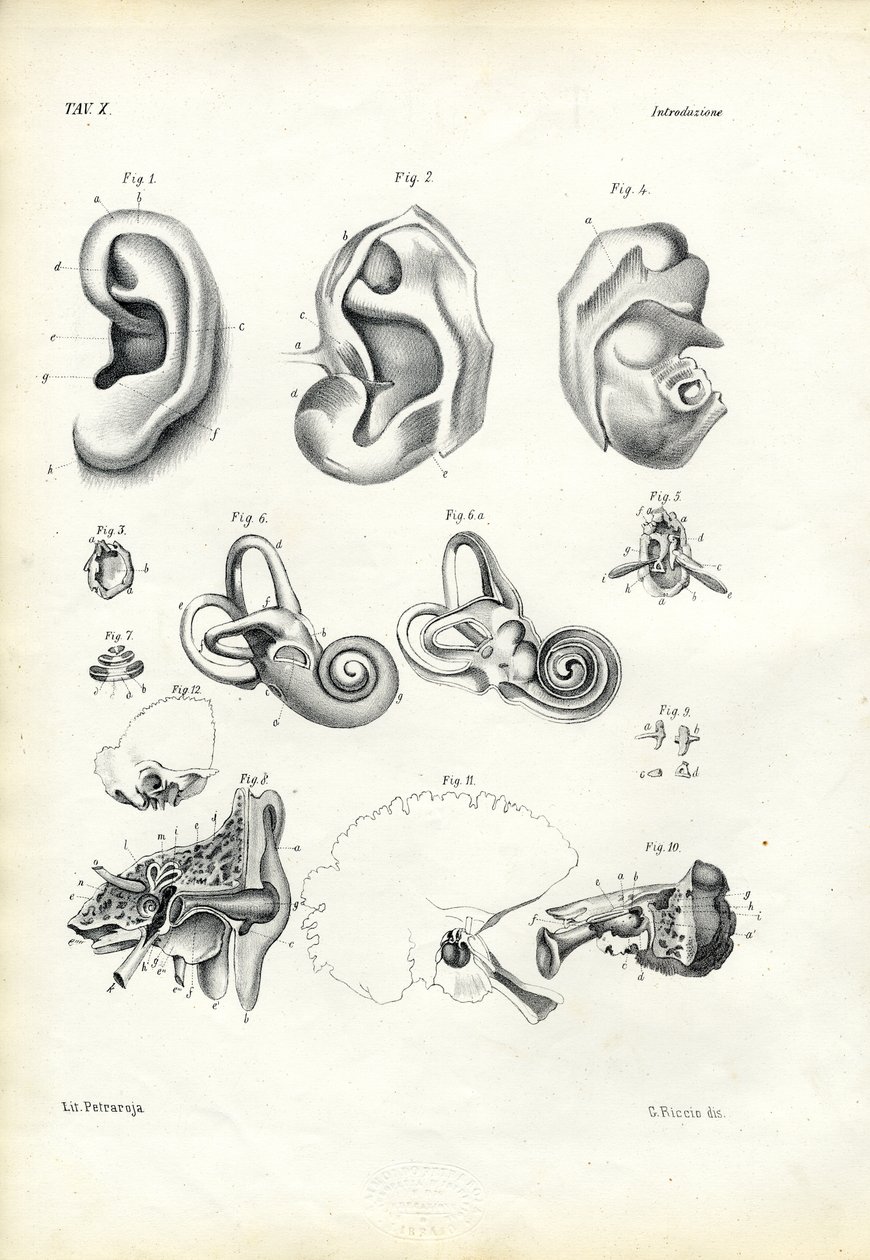 Kuuloelimet, 1863-79 tekijältä Raimundo Petraroja