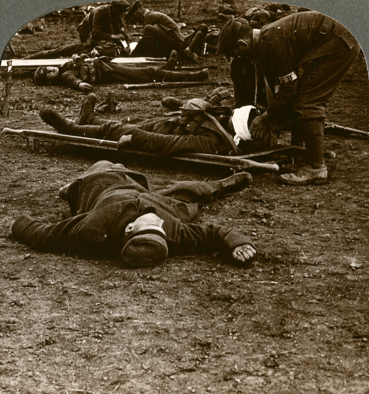Taistelun myrskyn ja stressin jälkeen haavoittuneiden hoito, ensimmäinen maailmansota, 1914-1918. tekijältä Realistic Travels Publishers