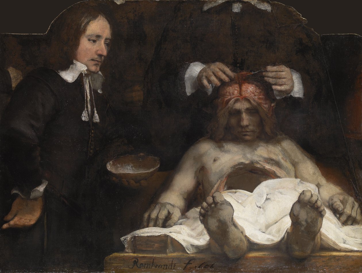 Tohtori Jan Deymanin anatomian oppitunti, 1656 tekijältä Rembrandt van Rijn