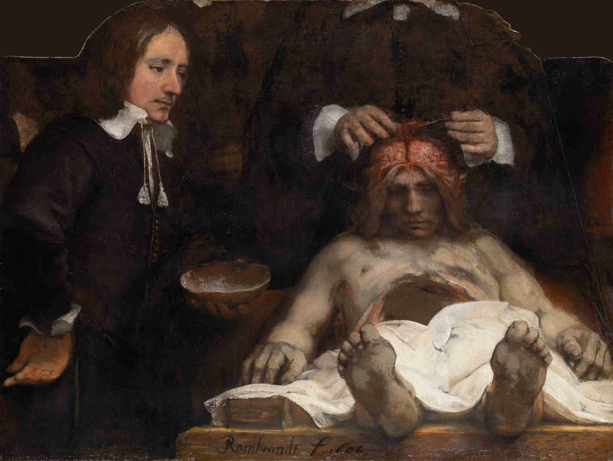Tohtori Jan Deijmanin anatomiatunti, 1656 tekijältä Rembrandt van Rijn