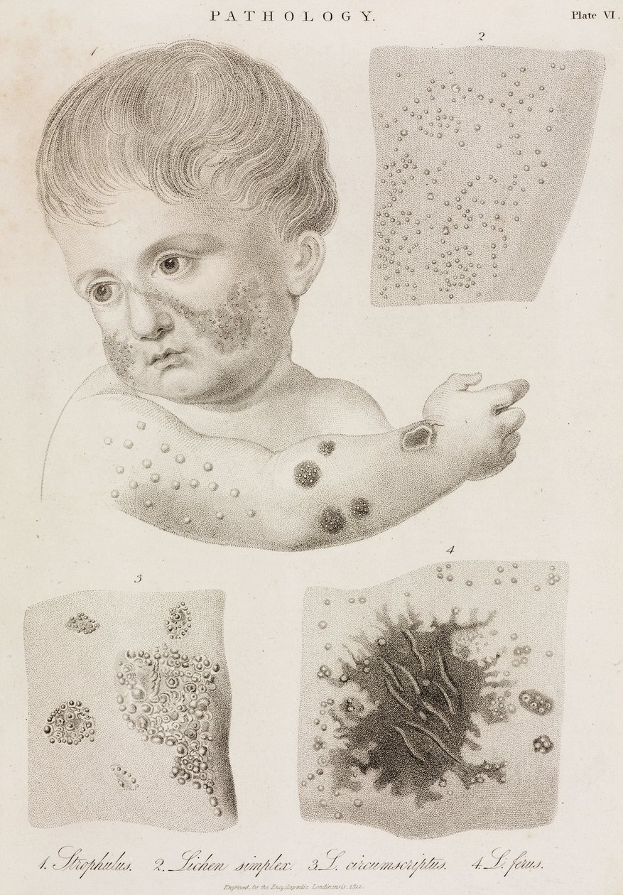 Dermatologia Ihosairauksien tyypit tekijältä John Pardon