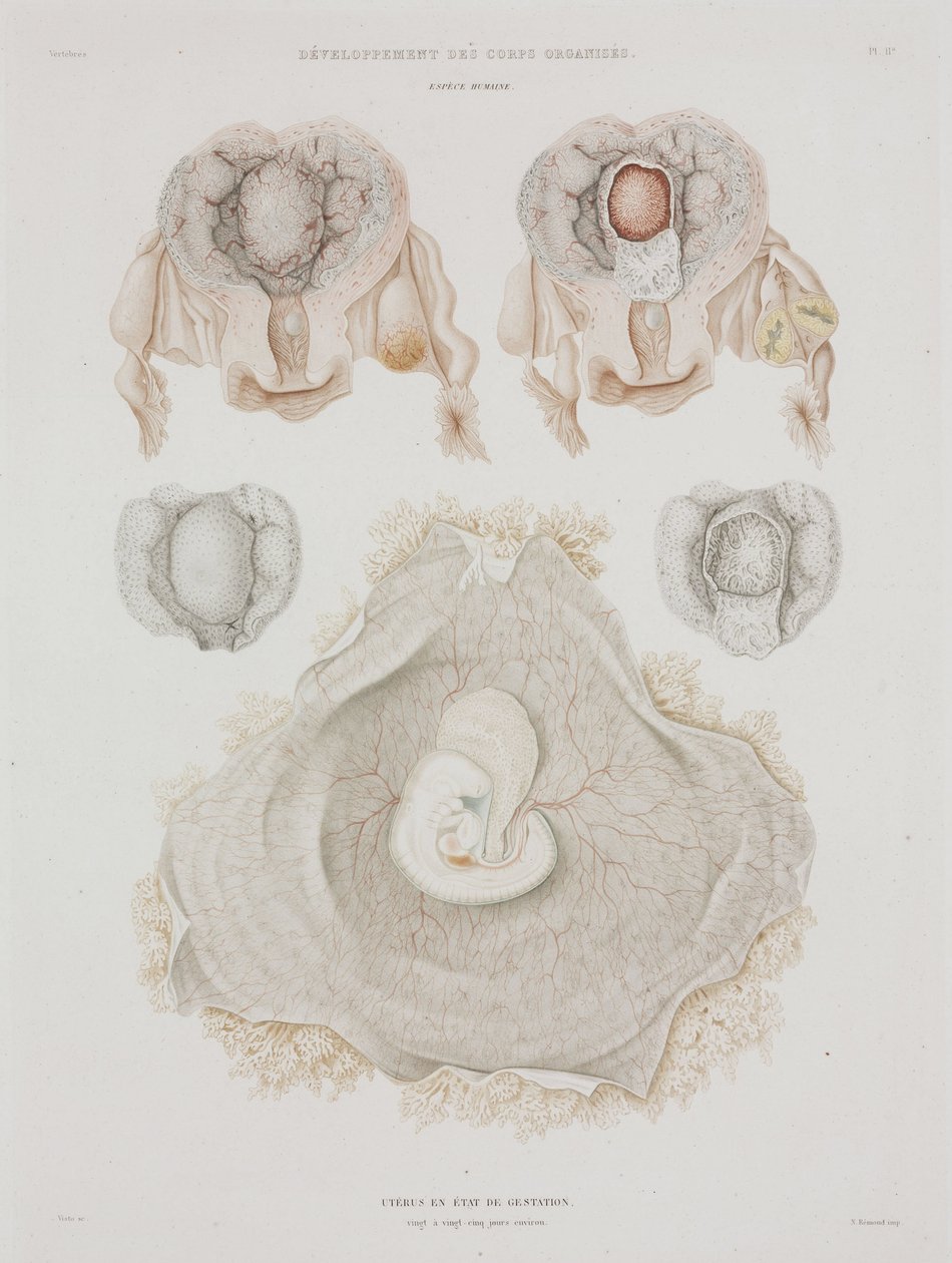 Gynekologia Ihmisen kohtu alkion kanssa, c 1847-1859 tekijältä John Pardon