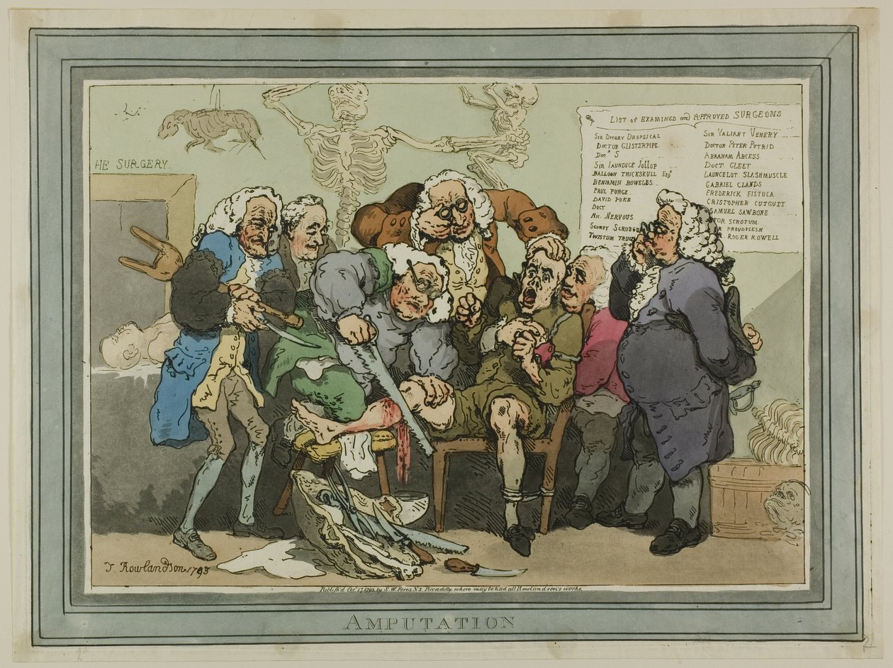 Amputaatio tekijältä Thomas Rowlandson