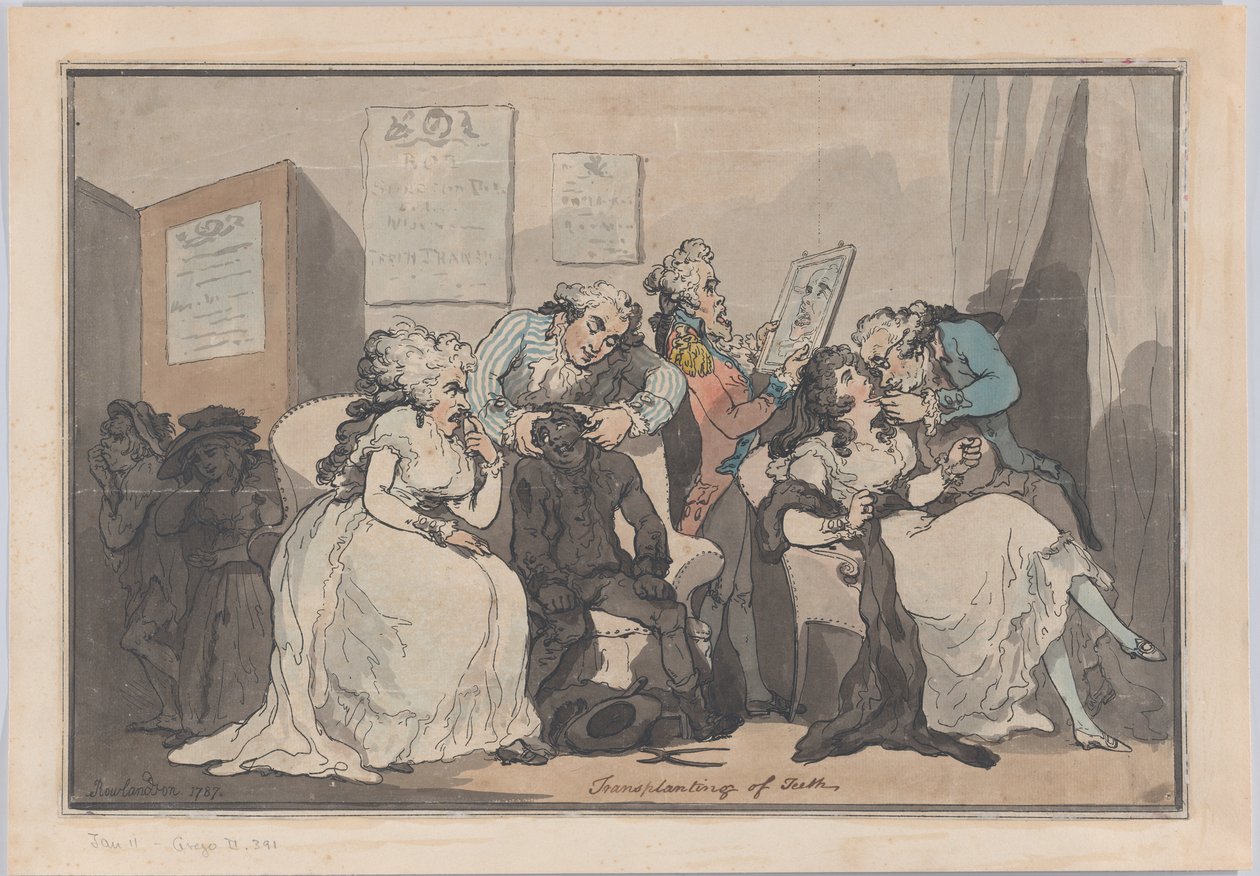 Hampaiden siirto, 1787, 1787. tekijältä Thomas Rowlandson