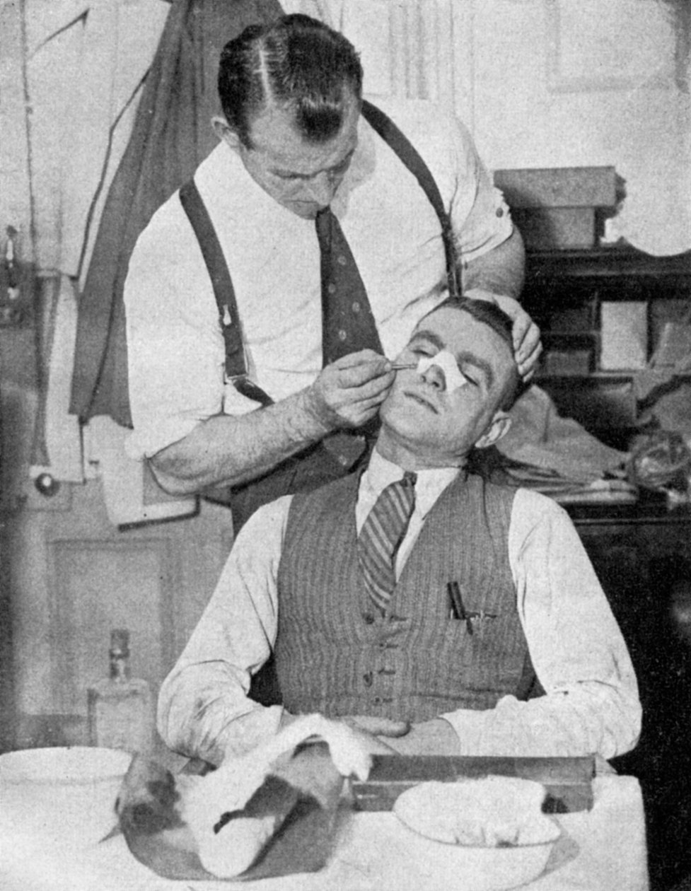 Englannin kapteeni Eddie Hapgood saa hoitoa murtuneesta nenästä vuoden 1934 Italian-ottelun jälkeen. tekijältä Topical Press Agency