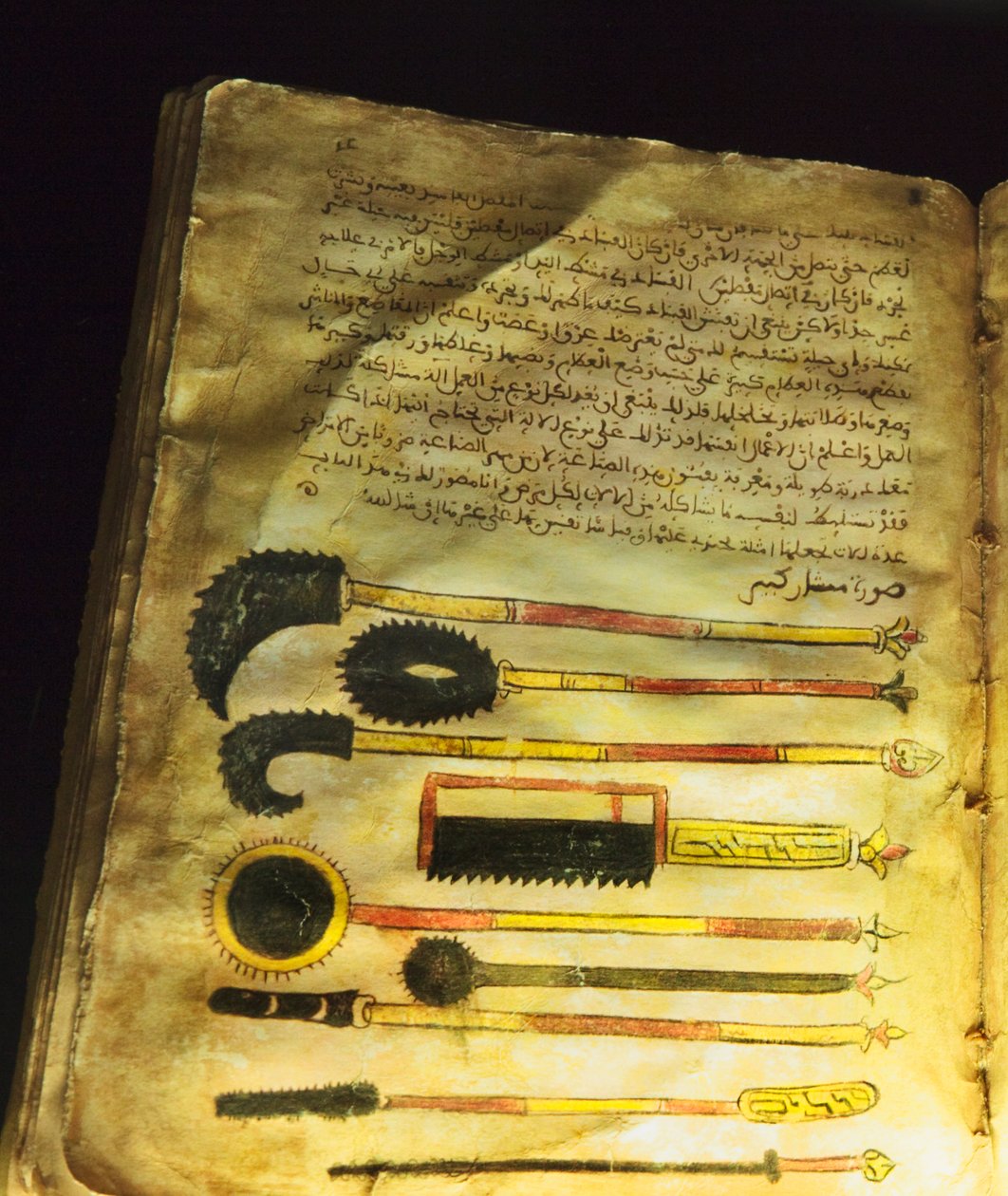 Kuvitus Abu al-Qasim al-Zahrawin teoksista "On Surgery and Instruments" tai "Al-Zahrawi" tekijältä Unbekannt Unbekannt