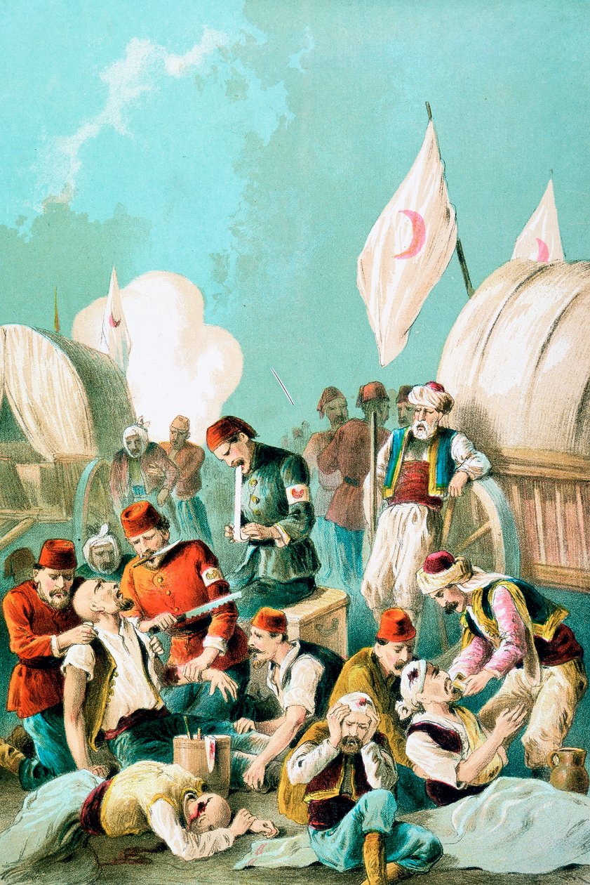 Käsi amputoidaan ilman nukutusta, Venäjän ja Turkin sota, 1877 tekijältä Unbekannt