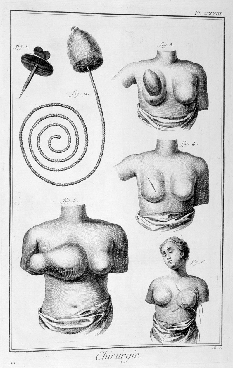 Rintaleikkaus, 1751-1777 tekijältä Unbekannt