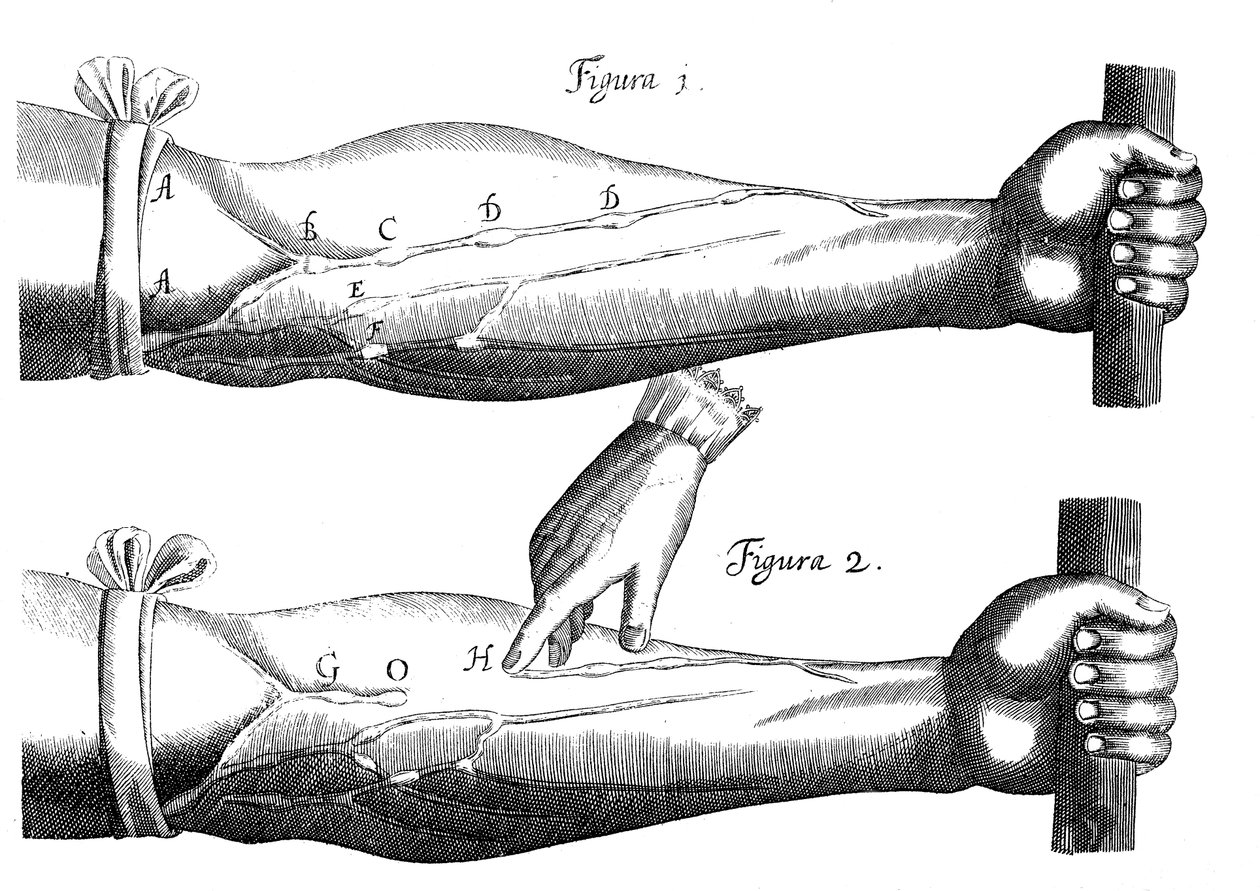 Verenkierto, 1628 tekijältä Unbekannt