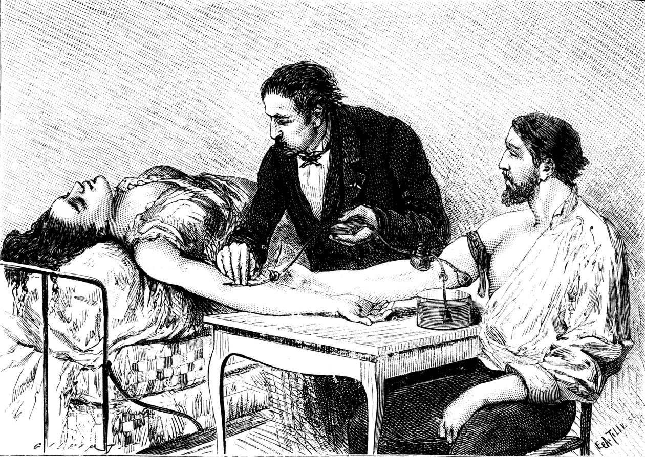 Tohtori Roussell Genevestä antaa naiselle suoran verensiirron vapaaehtoiselta, 1882 tekijältä Unbekannt