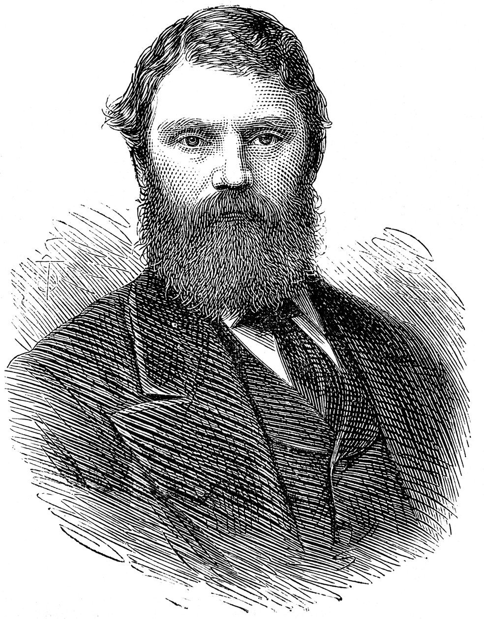 Francis Edmund Anstie 1833-1874, englantilainen lääkäri, 1874 tekijältä Unbekannt