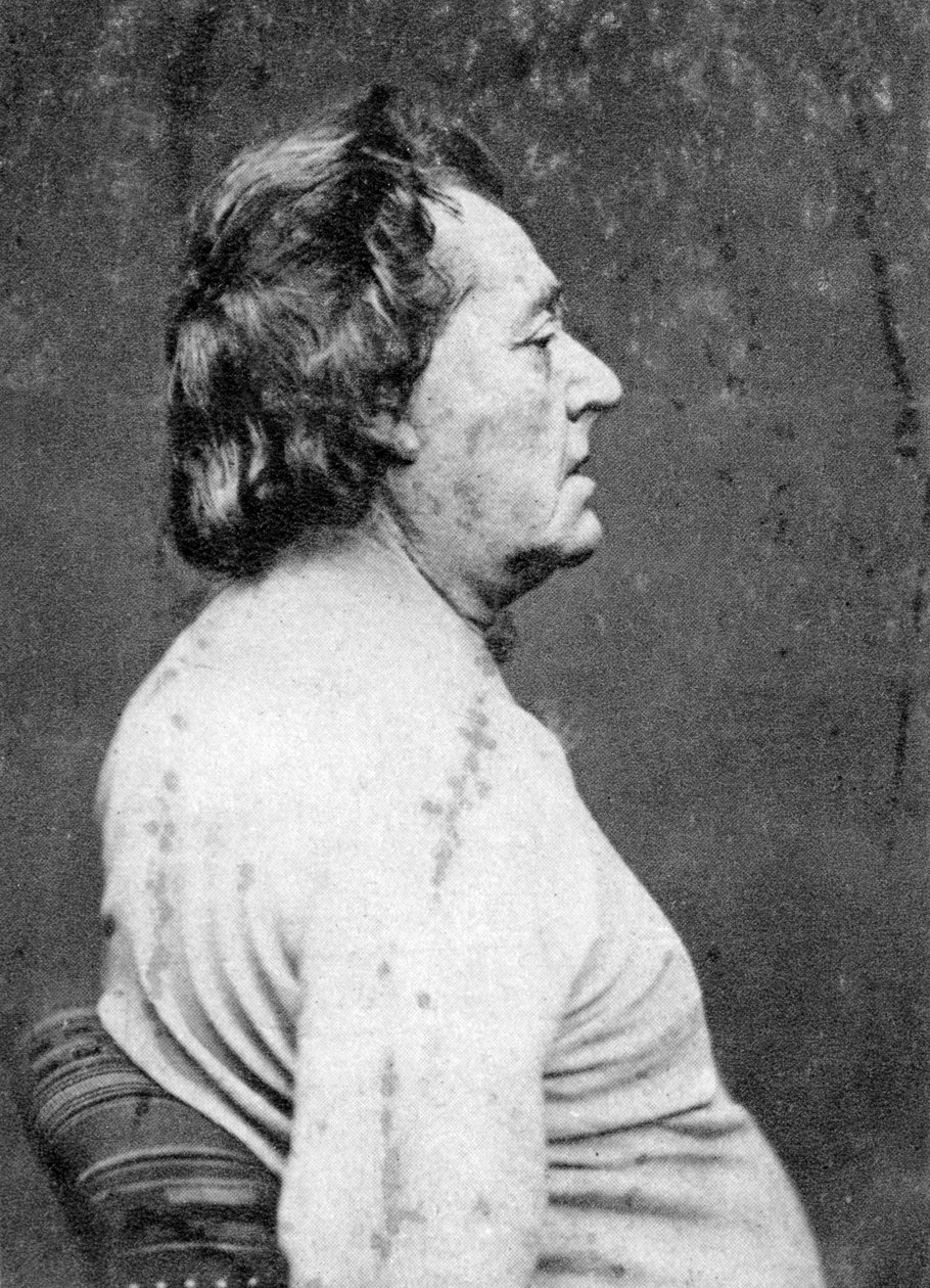 Frederick Lemaitre, ranskalainen näyttelijä ja näytelmäkirjailija, 1876 tekijältä Unbekannt