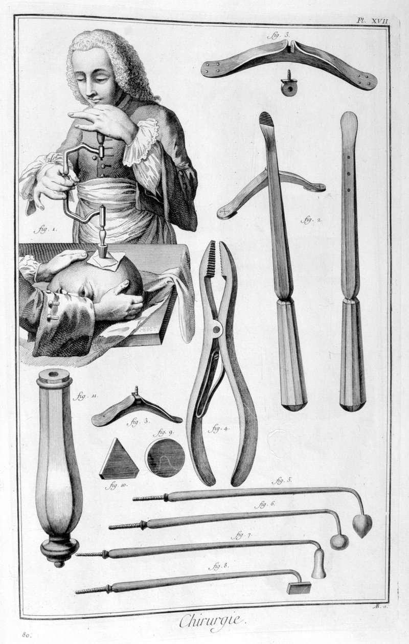 Pään leikkaus, 1751-1777 tekijältä Unbekannt