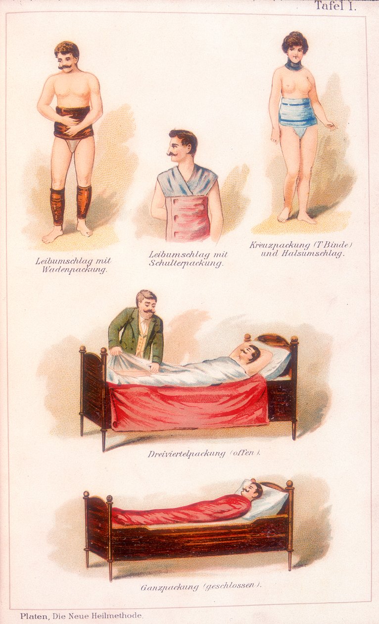 Vesiterapiahoidot, c1902 tekijältä Unbekannt