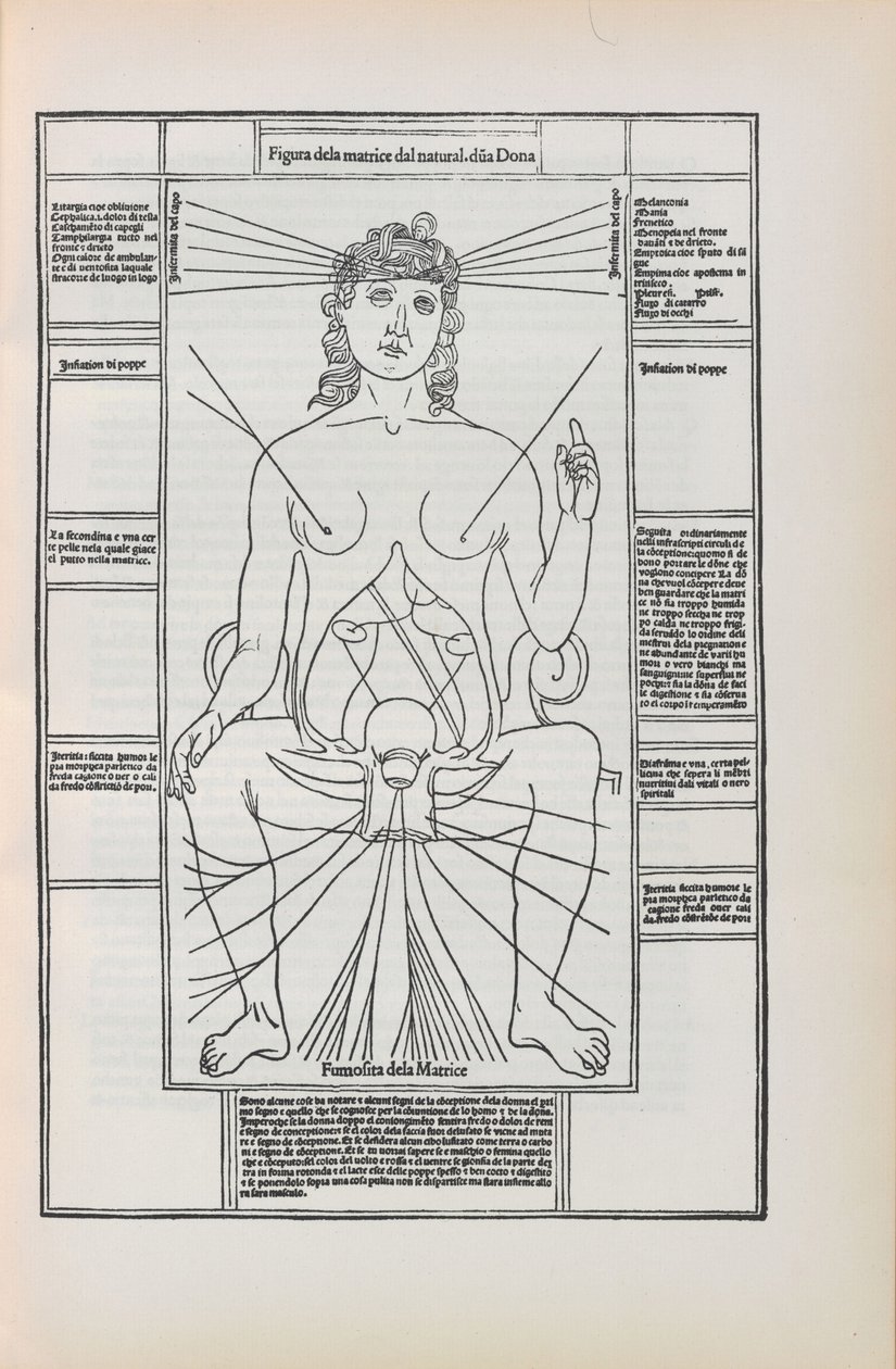 Kuvitus Johannes de Kethamin teoksesta Fasciculo di medicina, 1493. tekijältä Unbekannt