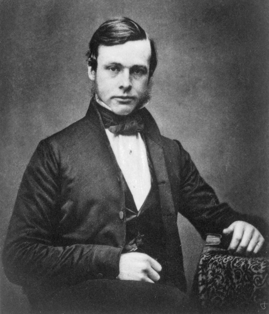 Joseph Lister, englantilainen kirurgi ja antiseptisen kirurgian pioneeri, 1855 tekijältä Unbekannt