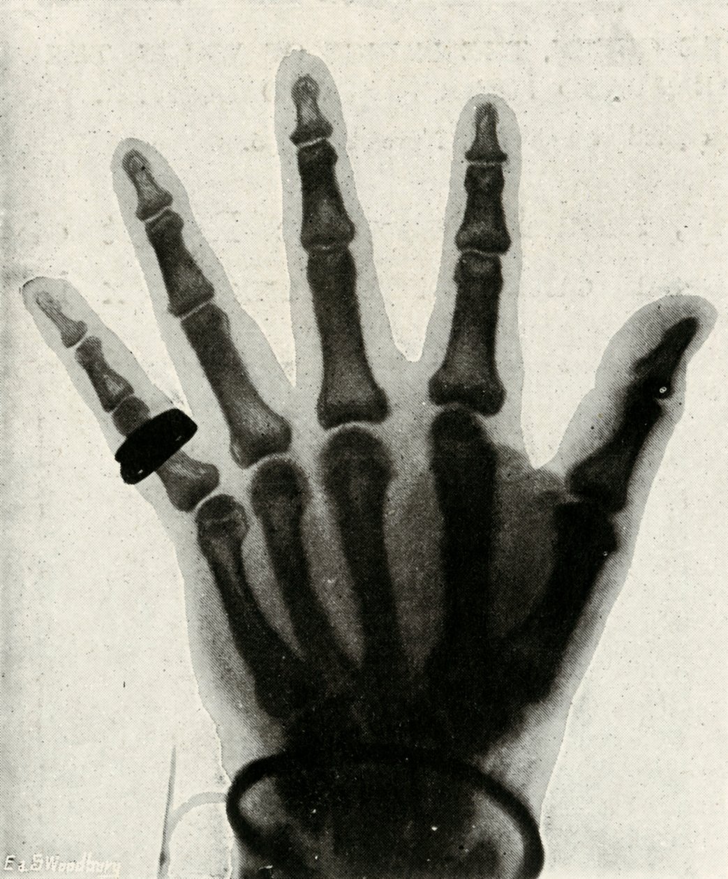 H.R.H.:n käden röntgenkuva Walesin prinssi, 1897 tekijältä Unbekannt