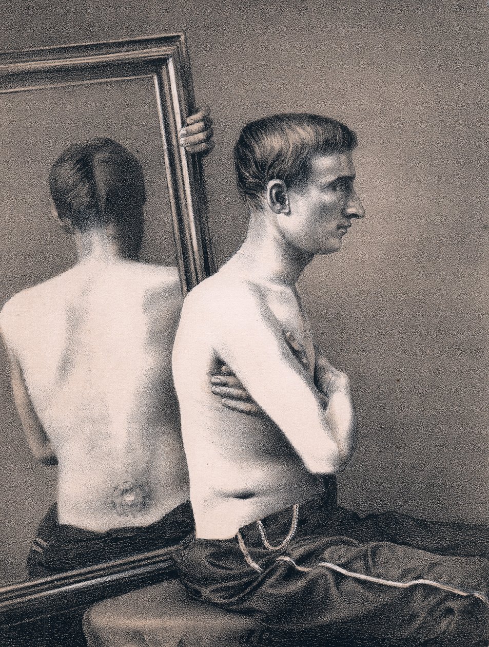 Toipumassa vatsaan saadusta luodista, Yhdysvaltain sisällissota, 1865 tekijältä Unbekannt