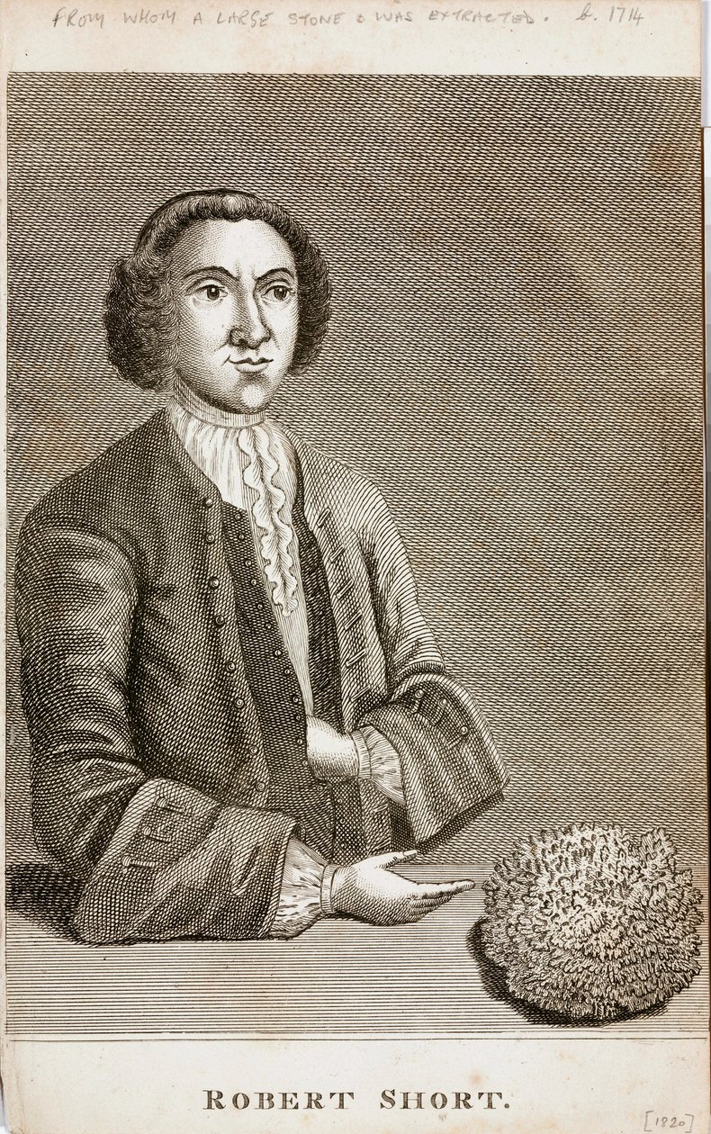 Robert Short, lääketieteellinen uteliaisuus, n. 1750-luku tekijältä Unbekannt