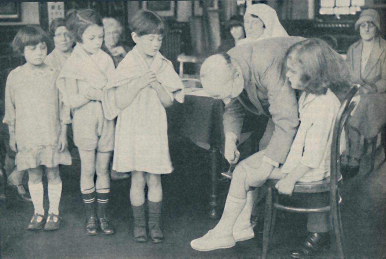 Polvilumpion refleksin testaus hermostosairauden varalta, c1935 tekijältä Unbekannt