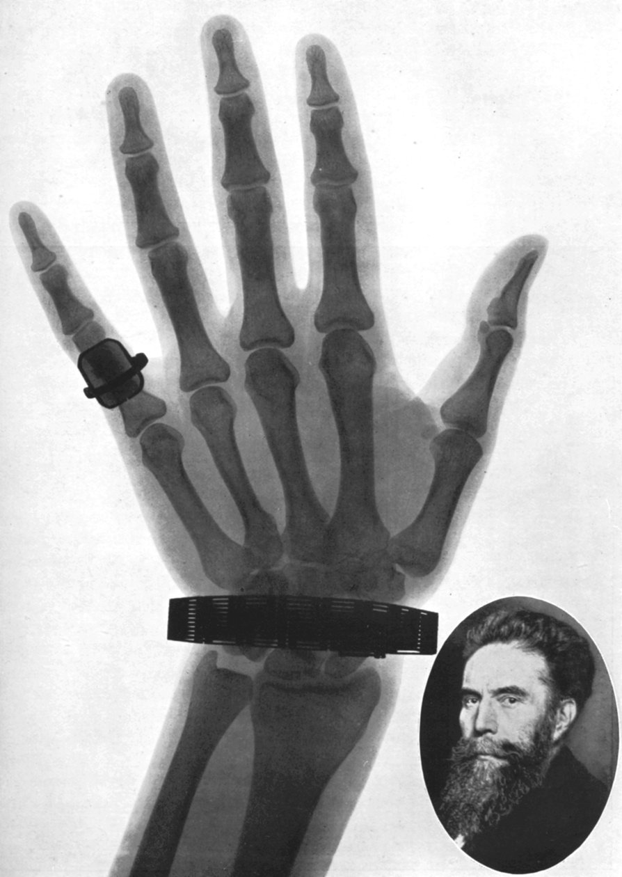 Röntgenkuva kädestä, 1926 tekijältä Unbekannt