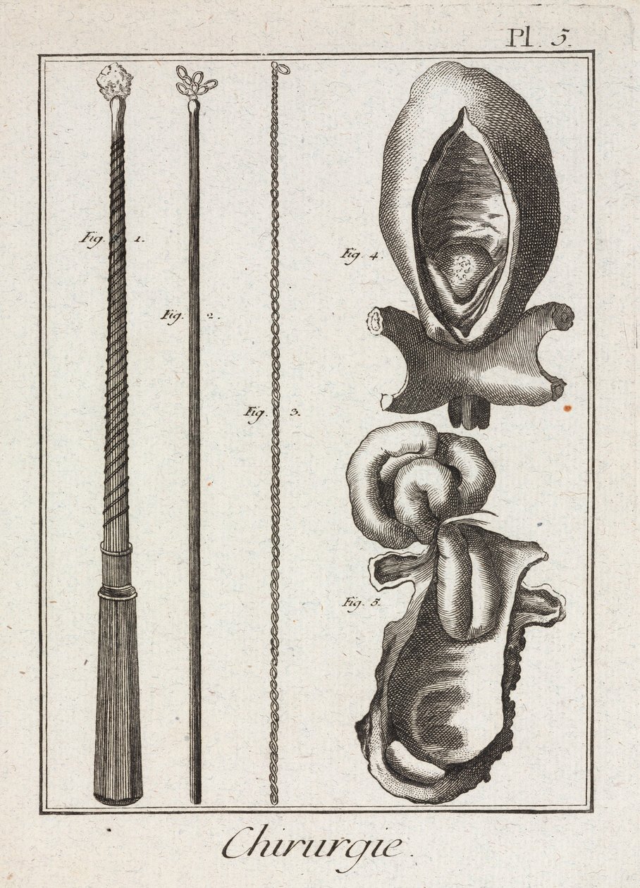 Laitteet, Early-Modern Kirurgiset instrumentit ja kaaviot kehon osista tekijältä Unbekannt