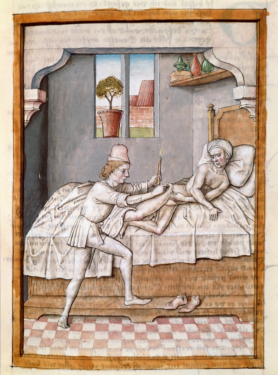 Lääkäri hoitaa miniatyyripotilasta Bidpain "Kalilan (Calila) ja Dimnan" tarinoiden saksankielisestä käännöksestä. (ms. 1389, fol. 23) noin 1480 Chantilly, museo Conde tekijältä Unknown artist