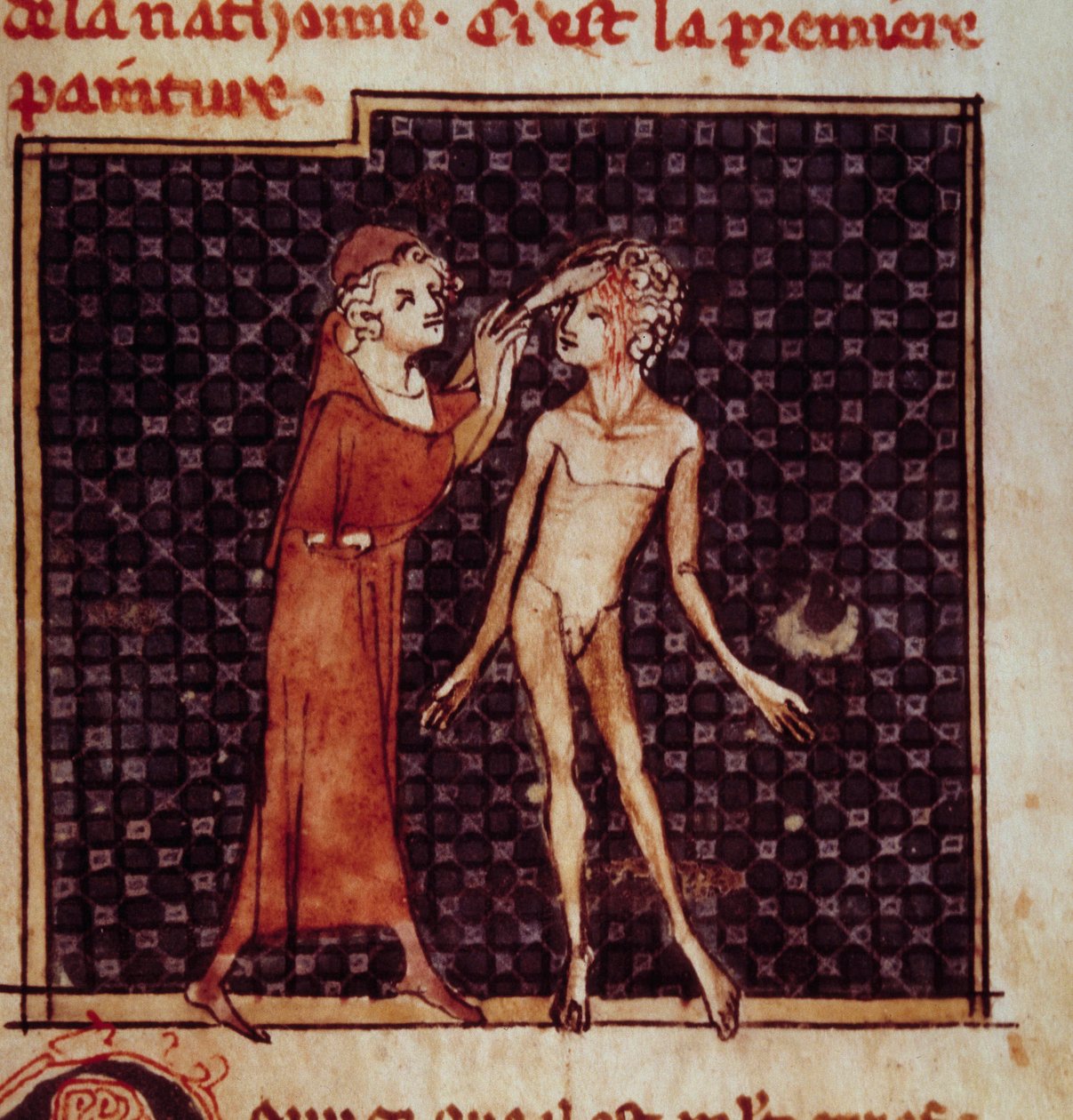 Anatominen hahmo: Kirurgi viiltää potilaan otsan. Miniatyyri käsikirjoituksesta "" Surgery" (Folio 8), jonka on kirjoittanut Henri de Mondeville (anatomian professori Philippe Le Belin kirurgi) tekijältä Unknown artist