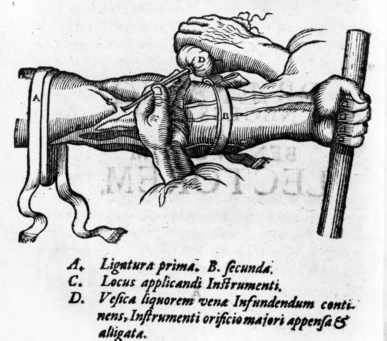 Anatominen lauta: erilaisia ligatuureja. Englantilaisen lääkärin William Harveyn (1578-1657) työ verijärjestelmään. Hän kuvaili verenkiertoa kehossa suonten välityksellä tekijältä Unknown artist