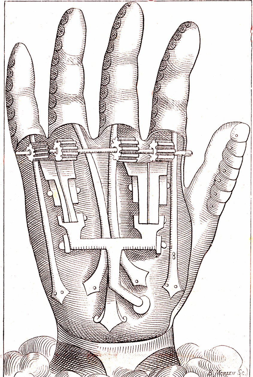 Ranskalaisen kirurgin anatomin Ambroise Parin keinotekoinen käsiproteesi tekijältä Unknown artist